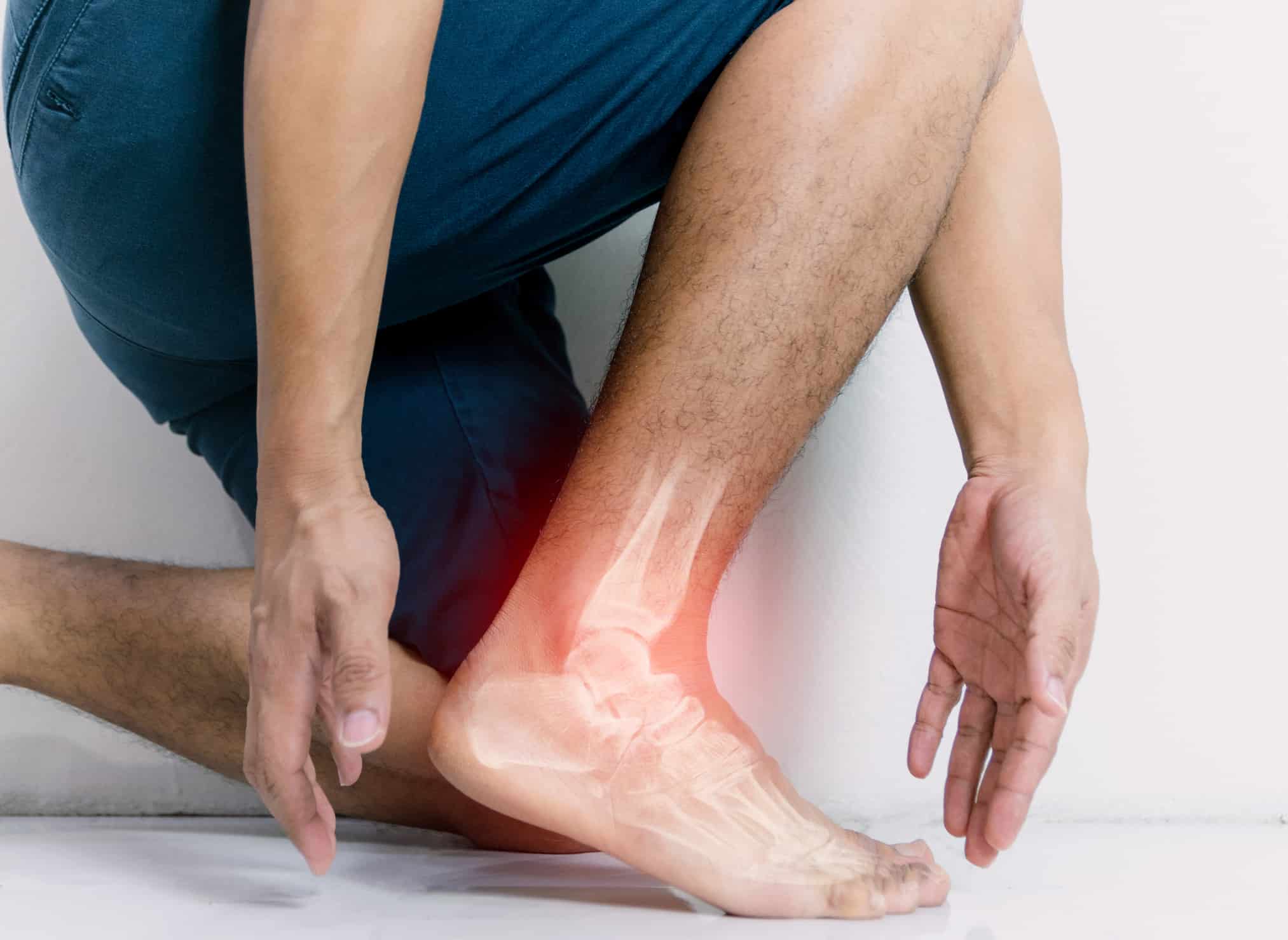 Inflammation
